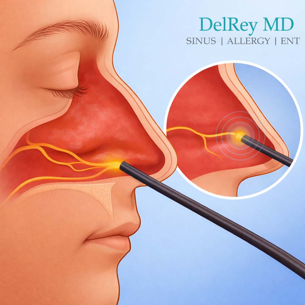RhinAer® Treatment for Chronic Rhinitis
